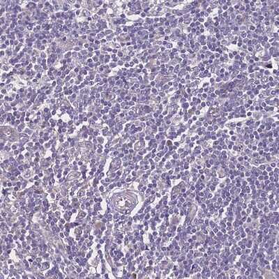 Immunohistochemistry-Paraffin ZNF248 Antibody - BSA Free