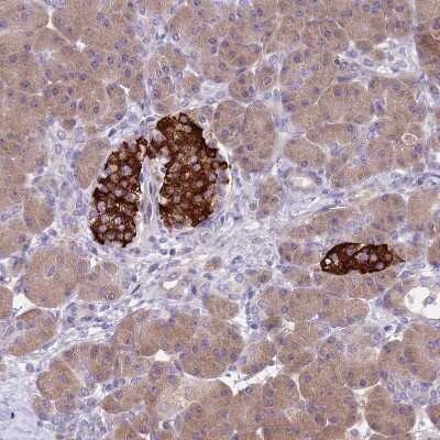 Immunohistochemistry-Paraffin ZNF248 Antibody - BSA Free