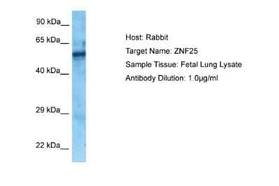 Western Blot: ZNF25 Antibody [NBP2-83840] - Host: Rabbit. Target Name: ZNF25. Sample Type: Fetal Lung lysates. Antibody Dilution: 1.0ug/ml