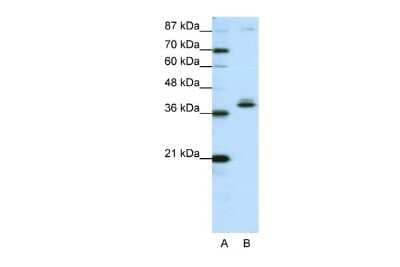 Western Blot: ZNF25 Antibody [NBP2-83842] - WB Suggested Anti-ZNF25 Antibody Titration: 1.25ug/ml. ELISA Titer: 1:62500. Positive Control: HepG2 cell lysate