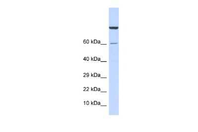 Western Blot: ZNF251 Antibody [NBP2-83844] - WB Suggested Anti-ZNF251 Antibody Titration: 0.2-1 ug/ml. ELISA Titer: 1:1562500. Positive Control: Human Muscle
