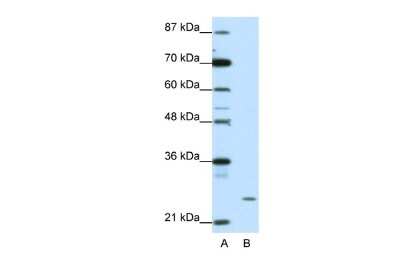Western Blot ZNF253 Antibody - BSA Free