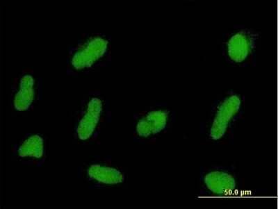 Immunocytochemistry/ Immunofluorescence ZNF254 Antibody - Azide and BSA Free
