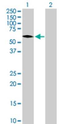 Western Blot ZNF257 Antibody