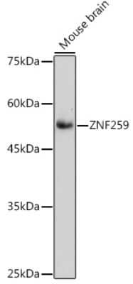 Western Blot: ZNF259 Antibody (10V1A2) [NBP3-15481] - Western blot analysis of extracts of Mouse brain, using ZNF259 antibody (NBP3-15481) at 1:1000 dilution. Secondary antibody: HRP Goat Anti-Rabbit IgG (H+L) at 1:10000 dilution. Lysates/proteins: 25ug per lane. Blocking buffer: 3% nonfat dry milk in TBST. Detection: ECL Basic Kit. Exposure time: 90s.