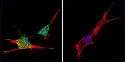 Immunocytochemistry/Immunofluorescence: ZNF259 Antibody (LG1) [NBP2-22448] - Analysis of ZPR1 in NIH-3T3 Cells. Cells were grown on chamber slides and fixed with formaldehyde prior to staining. Cells were probed without (control) or with a ZPR1 monoclonal antibody at a dilution of 1:20 overnight at 4C, washed with PBS and incubated with a DyLight-488 conjugated secondary antibody. ZPR1 staining (green), F-Actin staining with Phalloidin (red) and nuclei with DAPI (blue) is shown.