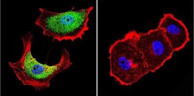 Immunocytochemistry/Immunofluorescence: ZNF259 Antibody (LG1) [NBP2-22448] - Analysis of ZPR1 in MCF-7 Cells. Cells were grown on chamber slides and fixed with formaldehyde prior to staining. Cells were probed without (control) or with a ZPR1 monoclonal antibody at a dilution of 1:20 overnight at 4C, washed with PBS and incubated with a DyLight-488 conjugated secondary antibody. ZPR1 staining (green), F-Actin staining with Phalloidin (red) and nuclei with DAPI (blue) is shown.