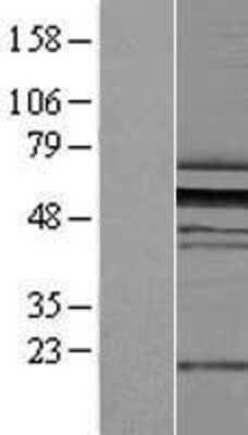 Western Blot: ZNF259 Overexpression Lysate (Adult Normal) [NBL1-18102] Left-Empty vector transfected control cell lysate (HEK293 cell lysate); Right -Over-expression Lysate for ZNF259.