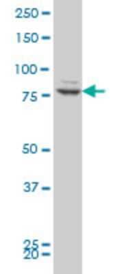 Western Blot: ZNF263 Antibody (2A1) [H00010127-M03] - Analysis of ZNF263 expression in Hela S3 NE (Cat # L013V3).