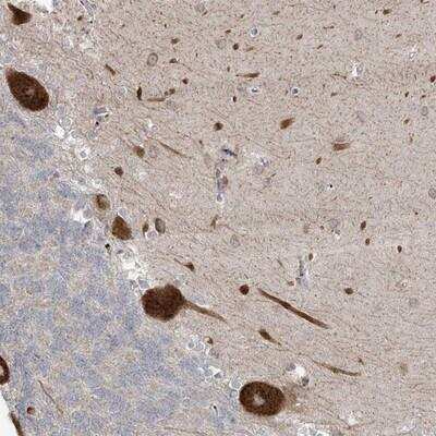 Immunohistochemistry-Paraffin: ZNF263 Antibody [NBP1-81869] - Staining of human cerebellum shows strong cytoplasmic positivity in Purkinje cells.