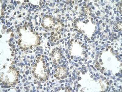 Immunohistochemistry: ZNF264 Antibody [NBP1-80297] - Human Lung cell Cellular data: alveolar cell Antibody Concentration: 4.0-8.0 ug/ml Magnification: 400X.
