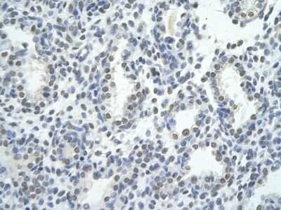 Immunohistochemistry: ZNF264 Antibody [NBP1-80298] - Human Lung cell Cellular data: alveolar cell Antibody Concentration: 4.0-8.0 ug/ml Magnification: 400X.
