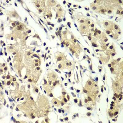 Immunohistochemistry-Paraffin: ZNF264 Antibody [NBP2-94825] - Paraffin-embedded human gastric using ZNF264 .