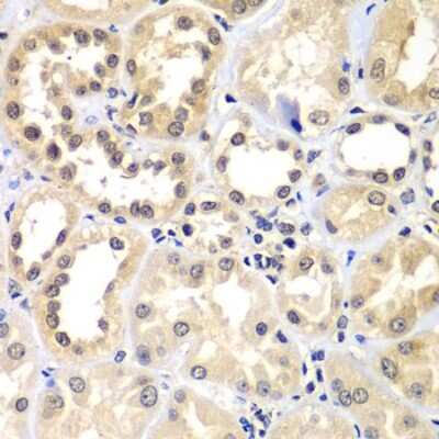 Immunohistochemistry-Paraffin: ZNF264 Antibody [NBP2-94825] - Paraffin-embedded human kidney using ZNF264 .