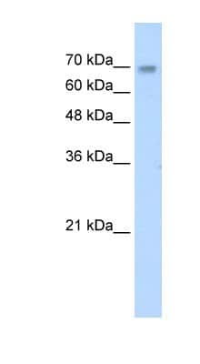 Western Blot: ZNF264 Antibody [NBP1-80298] - Jurkat cell lysate, concentration 0.2-1 ug/ml.