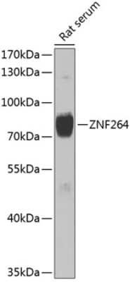 Western Blot: ZNF264 Antibody [NBP2-93068] - Analysis of extracts of rat serum, using ZNF264 at 1:1000 dilution.Secondary antibody: HRP Goat Anti-Rabbit IgG (H+L) at 1:10000 dilution.Lysates/proteins: 25ug per lane.Blocking buffer: 3% nonfat dry milk in TBST.Detection: ECL Basic Kit .Exposure time: 90s.