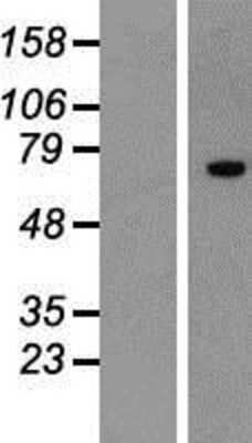 Western Blot ZNF264 Overexpression Lysate