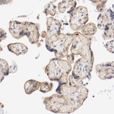Immunohistochemistry-Paraffin: ZNF267 Antibody [NBP1-81633] - Staining of human placenta shows weak membranous positivity in trophoblastic cells.