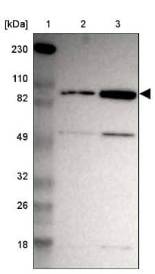 Western Blot: ZNF267 Antibody [NBP1-81633] - Lane 1: Marker [kDa] 230, 110, 82, 49, 32, 26, 18Lane 2: Human cell line RT-4Lane 3: Human cell line U-251MG sp
