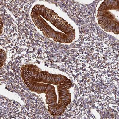 Immunohistochemistry-Paraffin ZNF268 Antibody - BSA Free