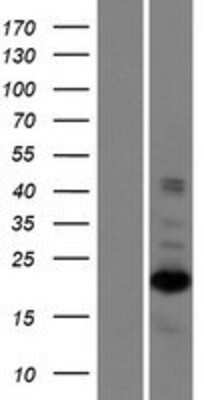 Western Blot: ZNF268 Overexpression Lysate (Adult Normal) [NBP2-10224] Left-Empty vector transfected control cell lysate (HEK293 cell lysate); Right -Over-expression Lysate for ZNF268.