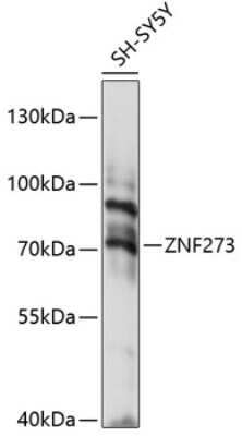 Western Blot: ZNF273 Antibody [NBP2-93912] - Analysis of extracts of SH-SY5Y cells, using ZNF273 at 1:1000 dilution.Secondary antibody: HRP Goat Anti-Rabbit IgG (H+L) at 1:10000 dilution.Lysates/proteins: 25ug per lane.Blocking buffer: 3% nonfat dry milk in TBST.Detection: ECL Basic Kit .Exposure time: 15s.