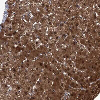 Immunohistochemistry-Paraffin ZNF274 Antibody - BSA Free