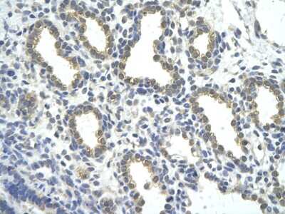 Immunohistochemistry-Paraffin: ZNF274 Antibody [NBP3-10523] - Immunohistochemical analysis of paraffin-embedded human lung tissue.