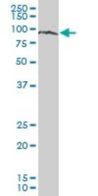 Western Blot: ZNF274 Antibody [H00010782-B01P] - Analysis of ZNF274 expression in human kidney.