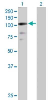 Western Blot: ZNF274 Antibody [H00010782-D01P] - Analysis of ZNF274 expression in transfected 293T cell line by ZNF274 polyclonal antibody.Lane 1: ZNF274 transfected lysate(74.20 KDa).Lane 2: Non-transfected lysate.