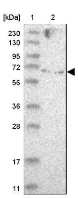 Western Blot ZNF274 Antibody - BSA Free