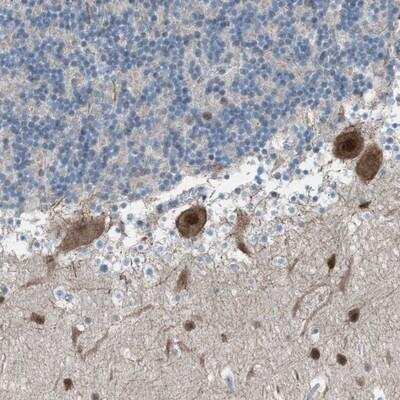 Immunohistochemistry-Paraffin: ZNF276 Antibody [NBP1-82681] - Staining of human cerebellum shows nuclear and cytoplasmic positivity in Purkinje and molecular layer cells.