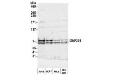 Western Blot ZNF276 Antibody - BSA Free