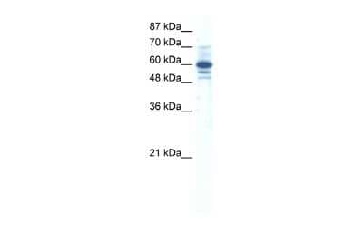 Western Blot: ZNF276 Antibody [NBP2-88658] - WB Suggested Anti-ZNF276 Antibody Titration: 0.2-1 ug/ml. ELISA Titer: 1:62500. Positive Control: HepG2 cell lysate