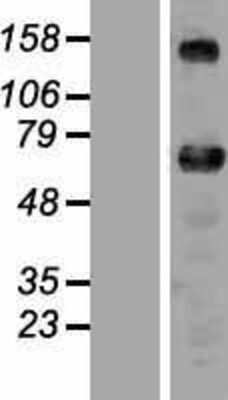 Western Blot ZNF276 Overexpression Lysate
