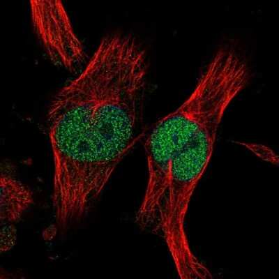 Immunocytochemistry/ Immunofluorescence ZNF277 Antibody - BSA Free
