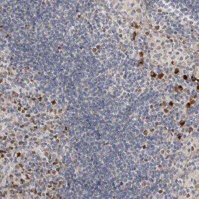 Immunohistochemistry-Paraffin ZNF277 Antibody - BSA Free