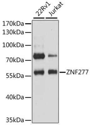 Western Blot: ZNF277 Antibody [NBP2-93373] - Analysis of extracts of various cell lines, using ZNF277 at 1:3000 dilution. Secondary antibody: HRP Goat Anti-Rabbit IgG (H+L) at 1:10000 dilution. Lysates/proteins: 25ug per lane. Blocking buffer: 3% nonfat dry milk in TBST. Detection: ECL Basic Kit . Exposure time: 10s.