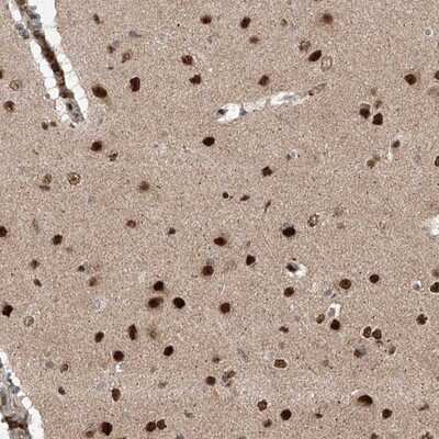 Immunohistochemistry-Paraffin: ZNF280D Antibody [NBP1-82207] - Staining of human cerebral cortex shows strong nuclear positivity.
