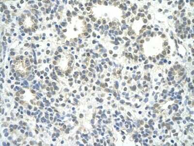 Immunohistochemistry-Paraffin: ZNF280D Antibody [NBP2-86467] - Rabbit Anti-ZNF280D antibody. Paraffin Embedded Tissue: Human Lung. Cellular Data: alveolar cell. Antibody Concentration: 4.0-8.0 ug/ml. Magnification: 400X