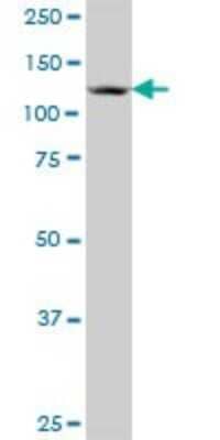 Western Blot: ZNF280D Antibody [H00054816-B01P] - Analysis of SUHW4 expression in Jurkat.