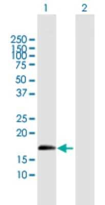 Western Blot: ZNF280D Antibody [H00054816-B01P] - Analysis of ZNF280D expression in transfected 293T cell line by ZNF280D polyclonal antibody.  Lane 1: SUHW4 transfected lysate(17.38 KDa). Lane 2: Non-transfected lysate.