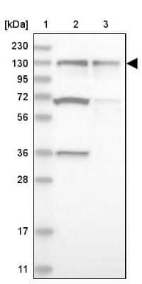 Western Blot: ZNF280D Antibody [NBP1-82207] - Lane 1: Marker [kDa] 230, 130, 95, 72, 56, 36, 28, 17, 11Lane 2: Human cell line RT-4Lane 3: Human cell line U-251MG sp