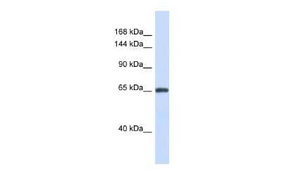 Western Blot: ZNF280D Antibody [NBP2-86467] - Host: Rabbit. Target Name: ZNF280D. Sample Type: Fetal Brain lysates. Antibody Dilution: 1.0ug/ml