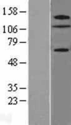 Western Blot: ZNF280D Overexpression Lysate (Adult Normal) [NBL1-18110] Left-Empty vector transfected control cell lysate (HEK293 cell lysate); Right -Over-expression Lysate for ZNF280D.