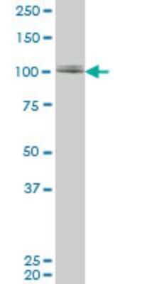 Western Blot: ZNF281 Antibody (1C9) [H00023528-M02] - ZNF281 monoclonal antibody (M02), clone 1C9. Analysis of ZNF281 expression in A-431.