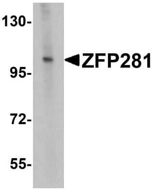 Western Blot: ZNF281 Antibody [NBP1-76551] - Analysis in A-20 cell lysate with antibody at 0.5 ug/mL.