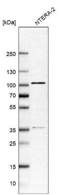 Western Blot: ZNF281 Antibody [NBP2-13564] - Analysis in human cell line NTERA-2.