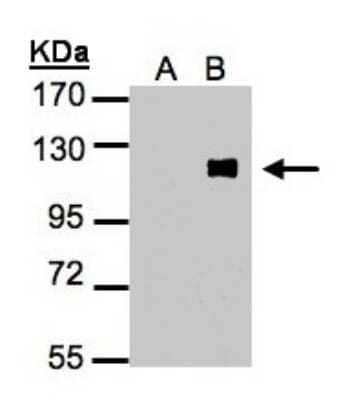Western Blot: ZNF281 Antibody [NBP2-20984] - A: Non-transfected lysate. B: ZNF281 transfected lysate. 7. 5% SDS PAGE gel, diluted at 1:500.