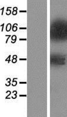 Western Blot: ZNF281 Overexpression Lysate (Adult Normal) [NBP2-07434] Left-Empty vector transfected control cell lysate (HEK293 cell lysate); Right -Over-expression Lysate for ZNF281.